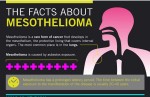 The Facts About Mesothelioma