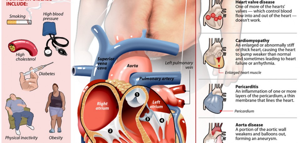 The Facts About Heart Disease [Infographic]